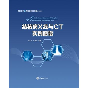 結(jié)核病X線與CT實例圖譜
