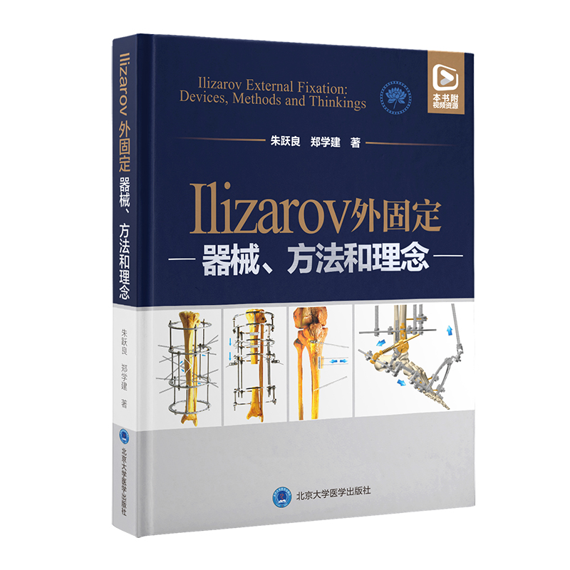Ilizarov̶е