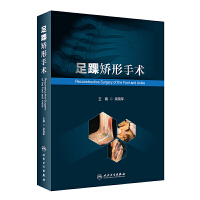 足踝矯形手術(shù)