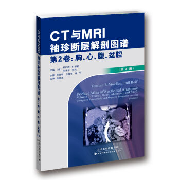 CTcMRIӽʈDV 2-ءǻ