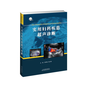 實(shí)用婦科疾患超聲診斷