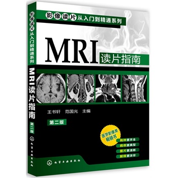 ӰxƬTͨϵ--MRIxƬָ(ڶ)(t(y)WӰNٰ棬NRȫDƬጸԔM)